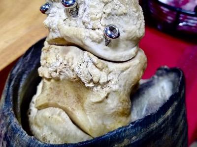 front view of a skeleton model of ringbone